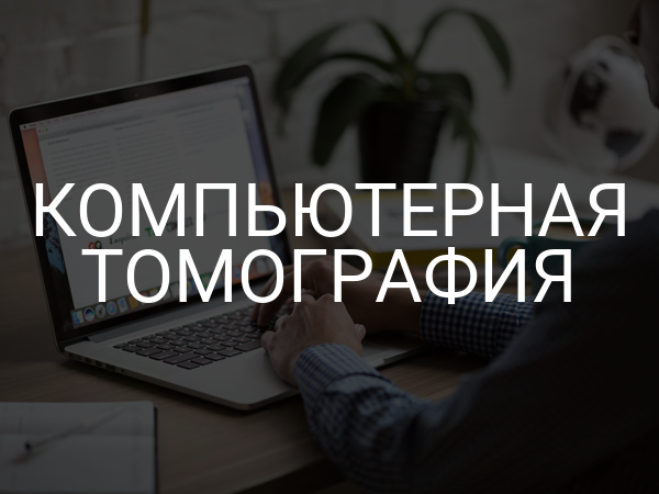 Компьютерная томография
